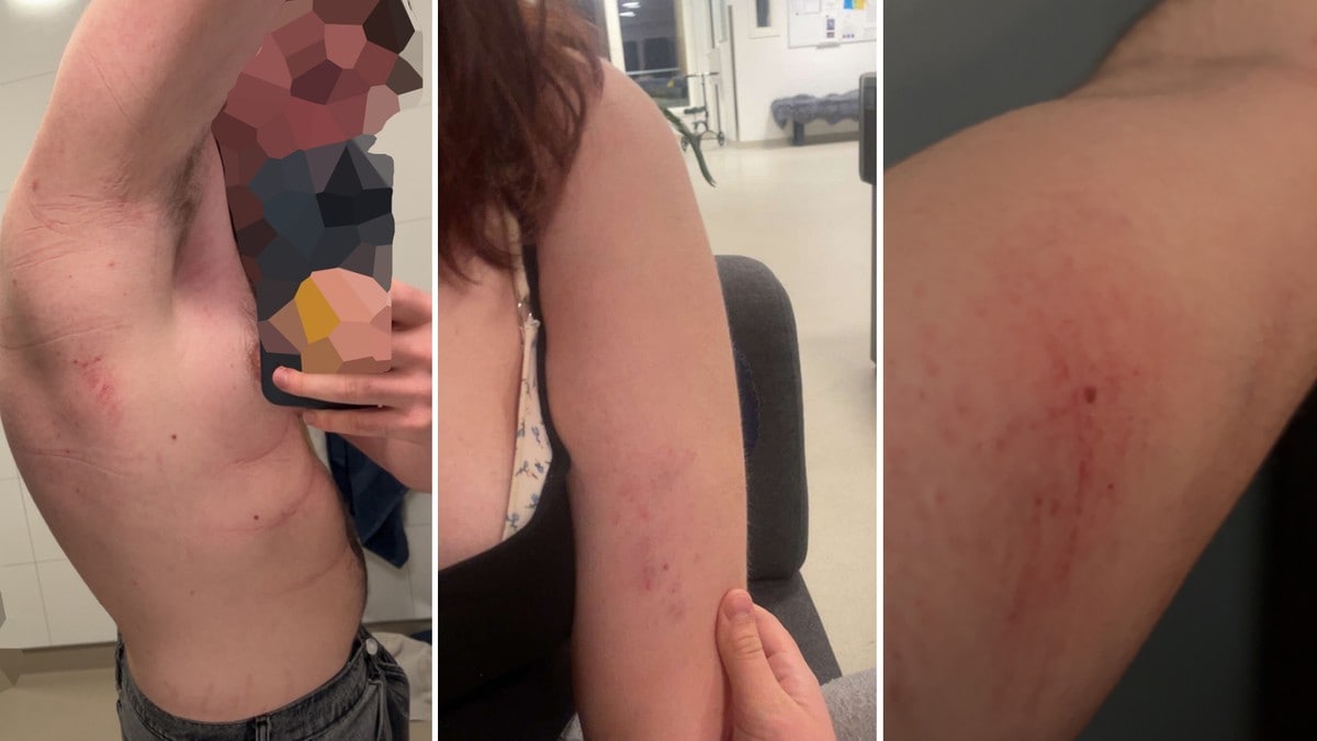 Ungdommer forteller om tvang og makt på ungdomshjem