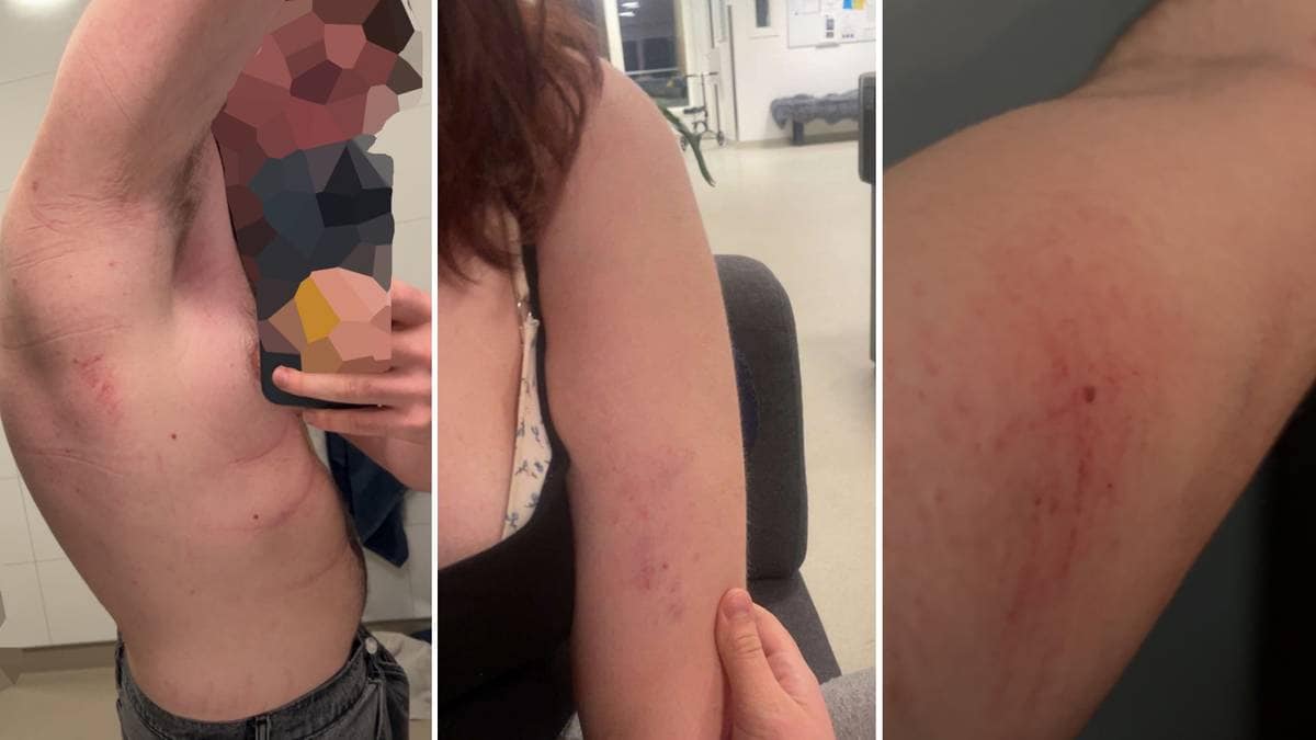 Ungdommer forteller om tvang og makt på ungdomshjem