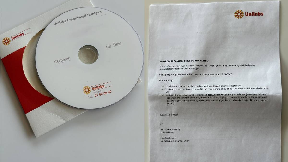 Unilabs bøyer av: Slutter med røntgenbilder på CD