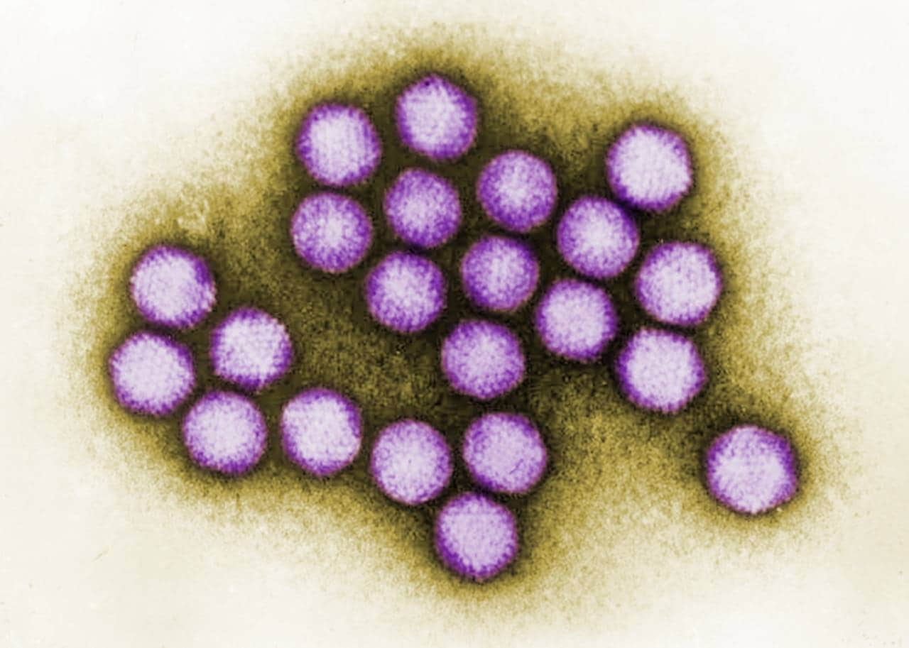 Adneovirus