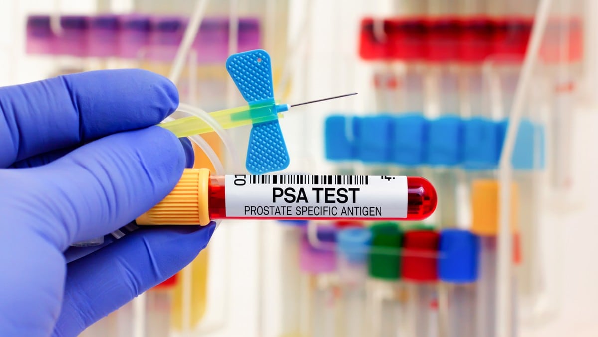 Vil avdekke prostatakreft med en enkel blodprøve