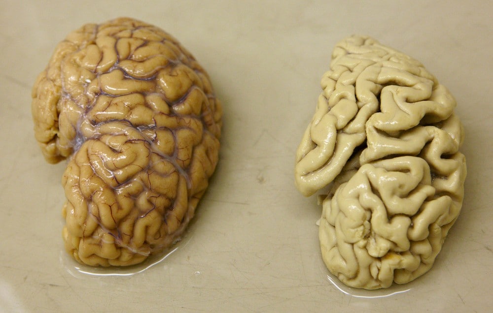 Norsk studie: Pusterytmen din kan ha en relevans til Alzheimer