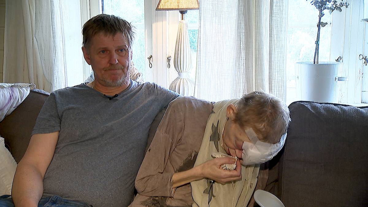 Tannpine var uhelbredelig kreft – NRK Sørlandet – Lokale nyheter, TV og radio