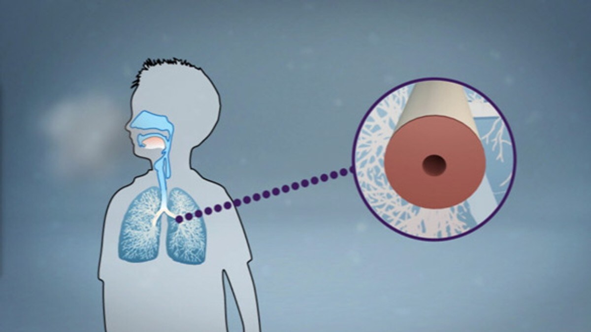 Slik trener du i kulda