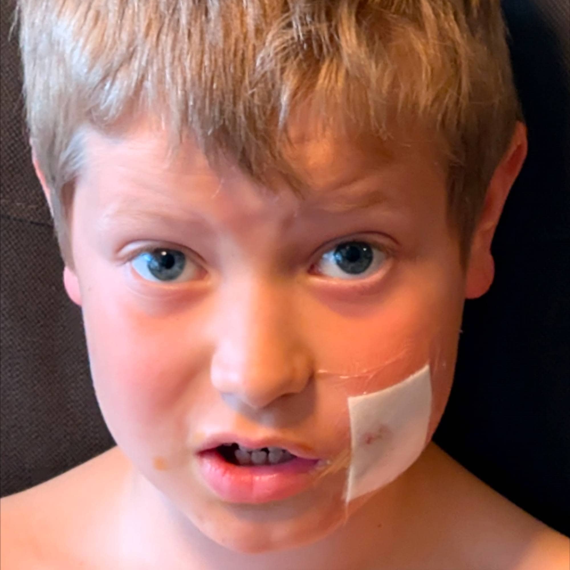 gutt med plaster på kinnet