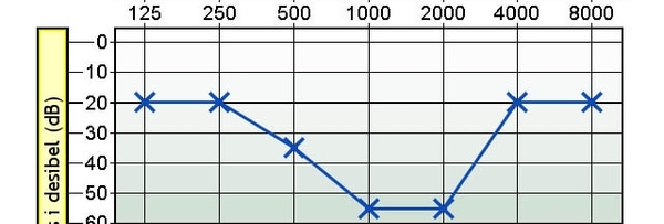 diagram, linjediagram som viser bassengtap