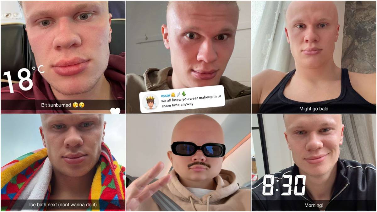 Haaland kan håve inn på eigne bilde: – Treng ikkje å spe på inntektene