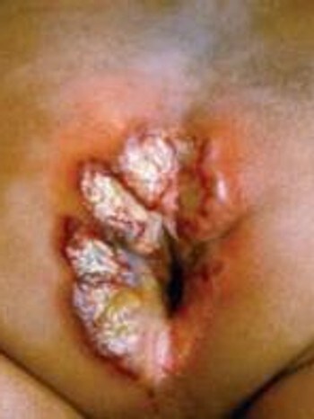 Rederiet - Oro Och Uppbrott, Season 3, Episode 15