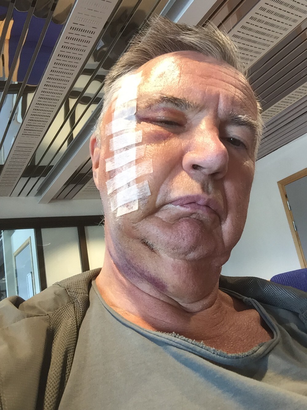 Kjell (67) ble sendt med rutefly etter hodeskader – klager til Fylkesmannen