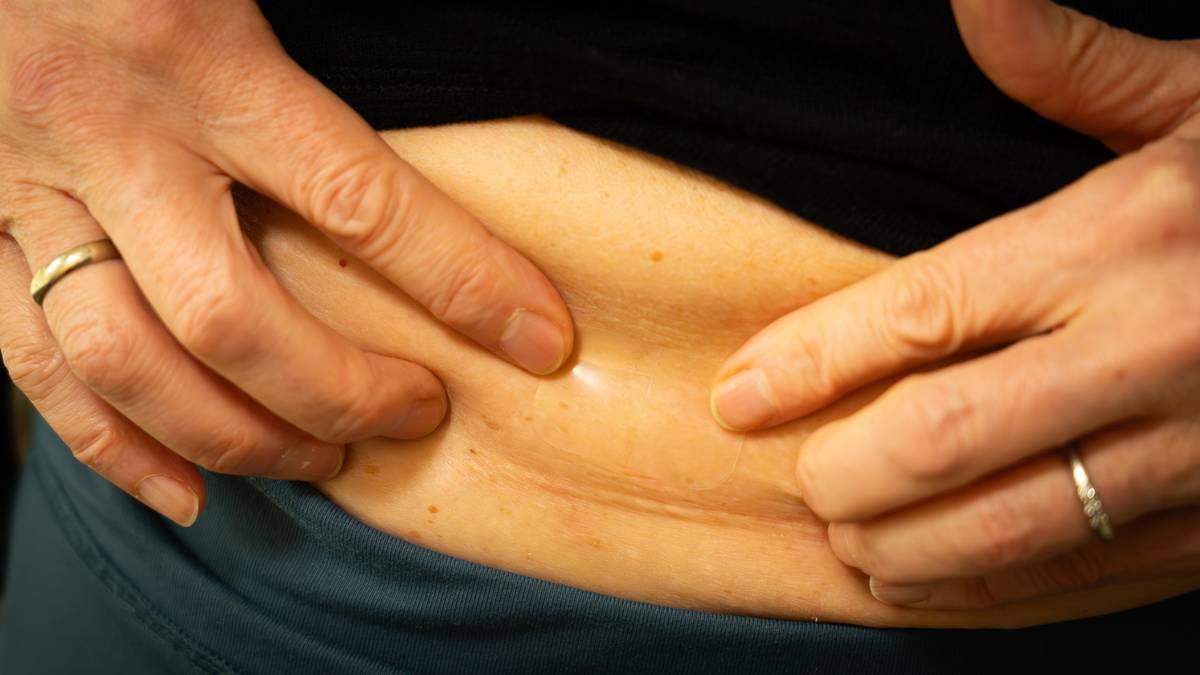 Før var det skamfullt. Nå er det big business og noe vi «må ha»