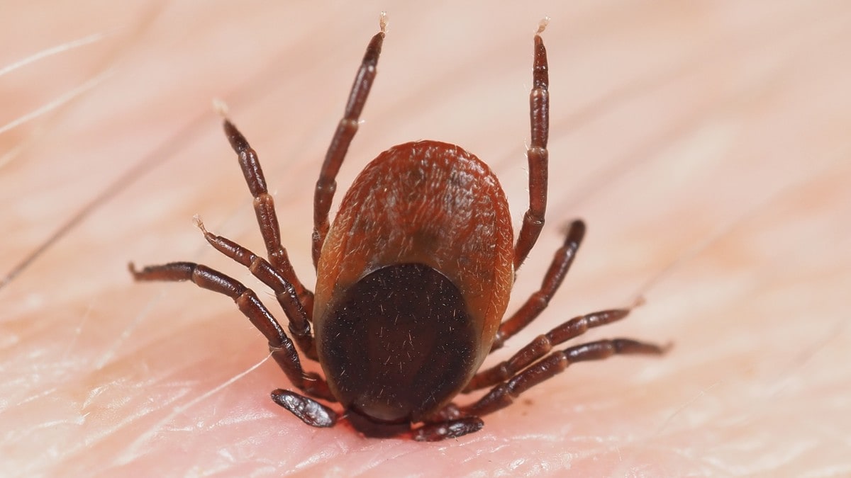 Flåttsykdom: Rekordhøye borreliosetall i juli