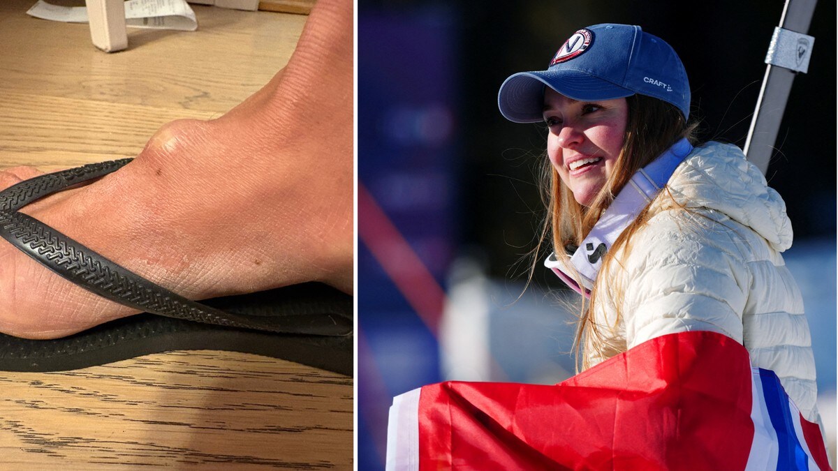 Tok OL-medalje med vond fot: – Skal rett på operasjonsbenken