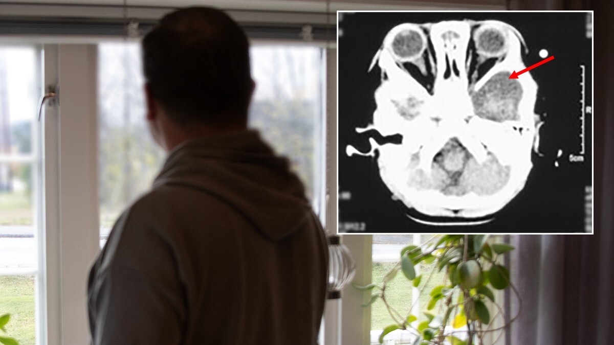Nytt medisinsk funn kan snu opp ned på dom for filleristing