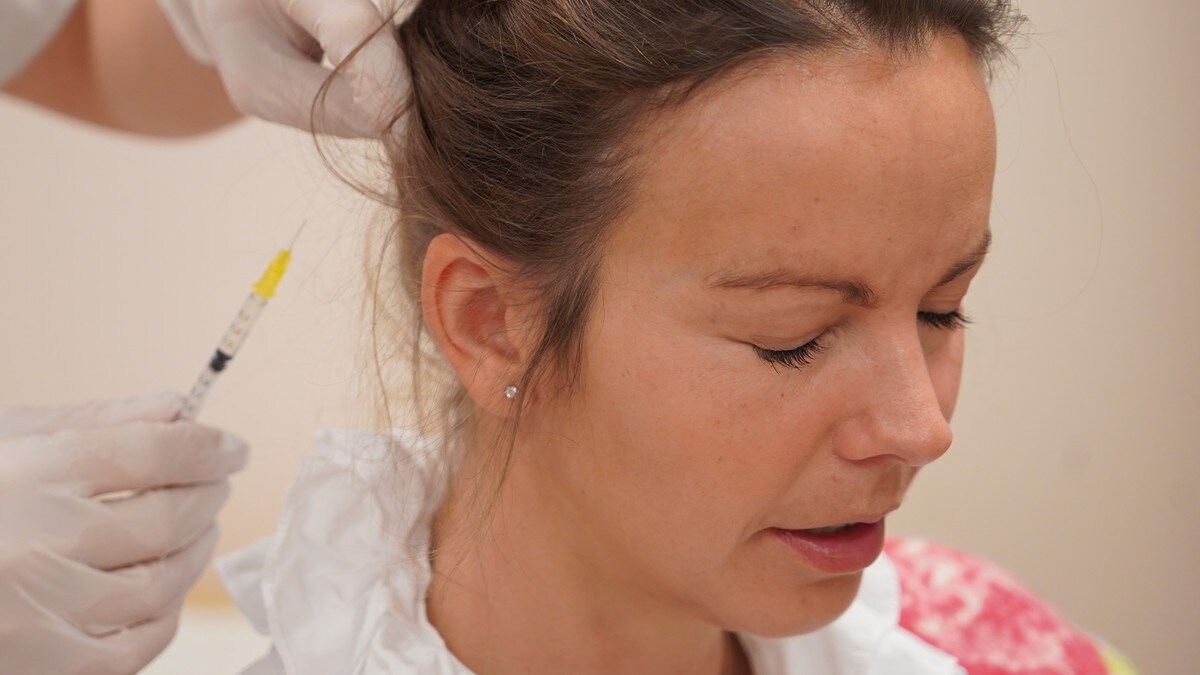 Ny migrenebehandling: Internasjonal studie på CGRP-hemmere og Botox