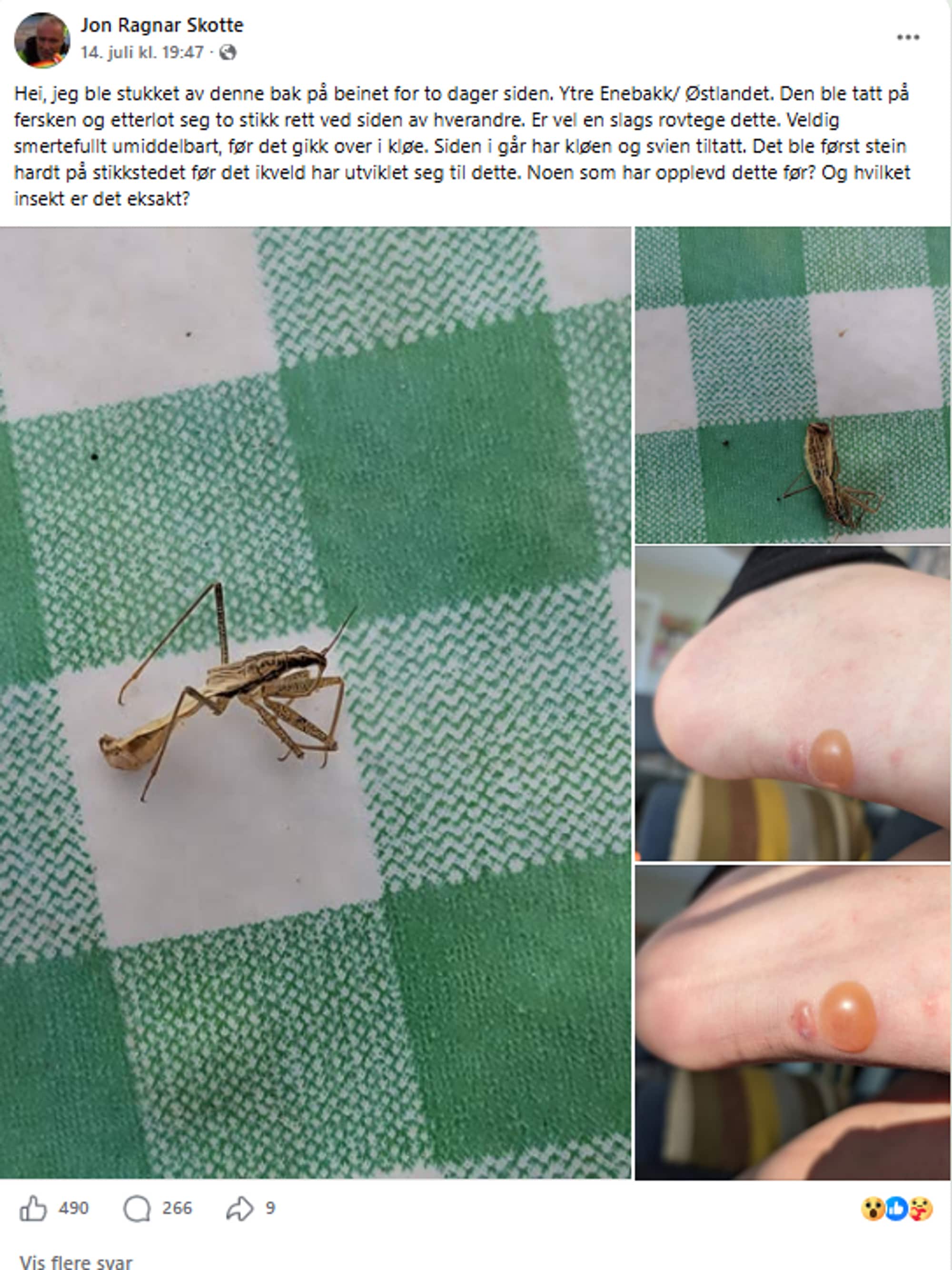 Bildet viser innlegget hans av insektet han ble bitt av pluss blemmen han fikk i ettertid. Det er også et par kommentarer under bildet som ber han om å oppsøke helsehjelp. 