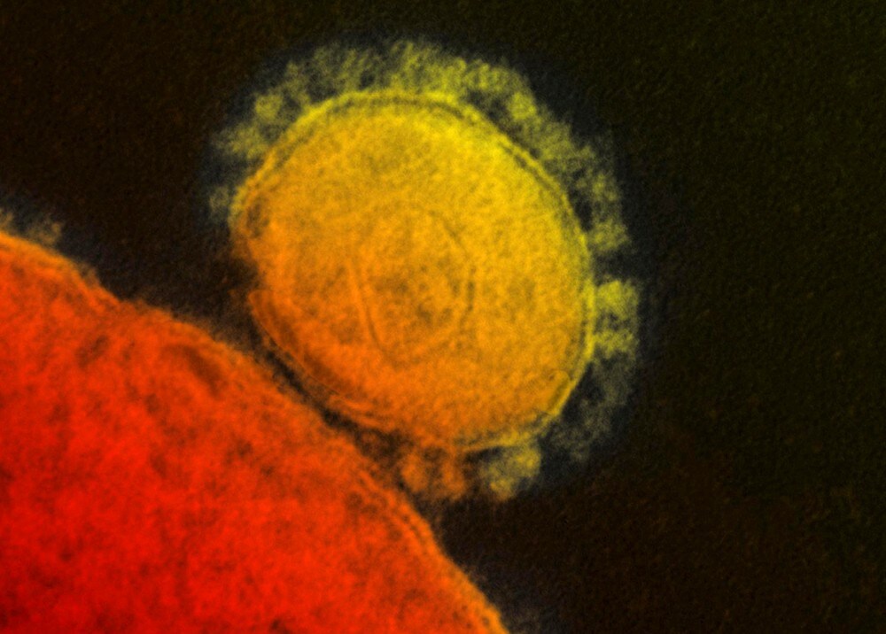 WHO melder: Det nye viruset smitter mellom mennesker og kan spre seg videre