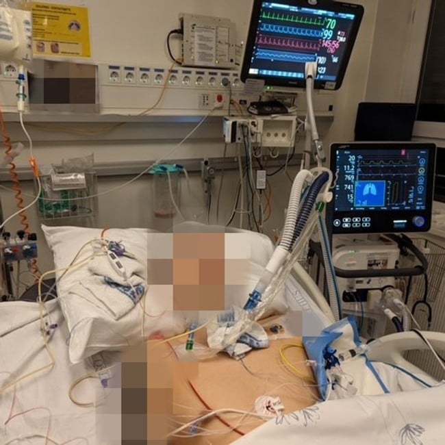 Bildet viser en sladdet person som ligger i en sykehusseng. Mange elektroder er festet til kroppen hans og vi ser flere skjermer.