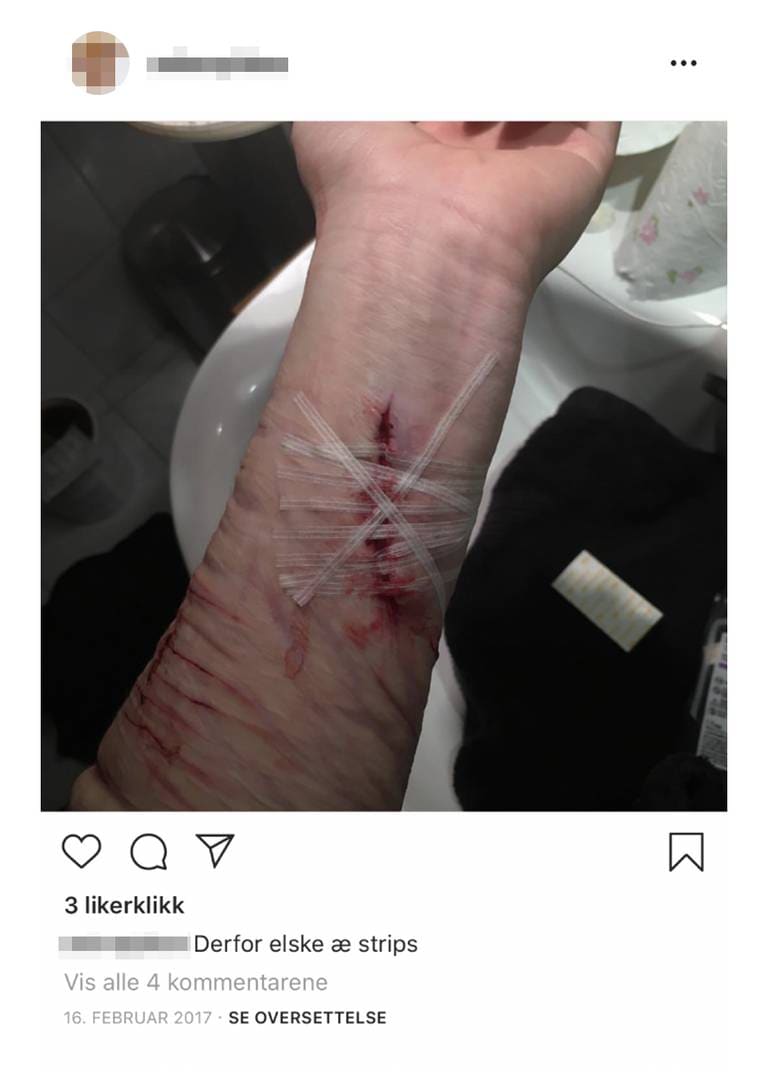 Instagram-bilde av en arm med grove kutt og strips og teksten: Derfor elske æ strips