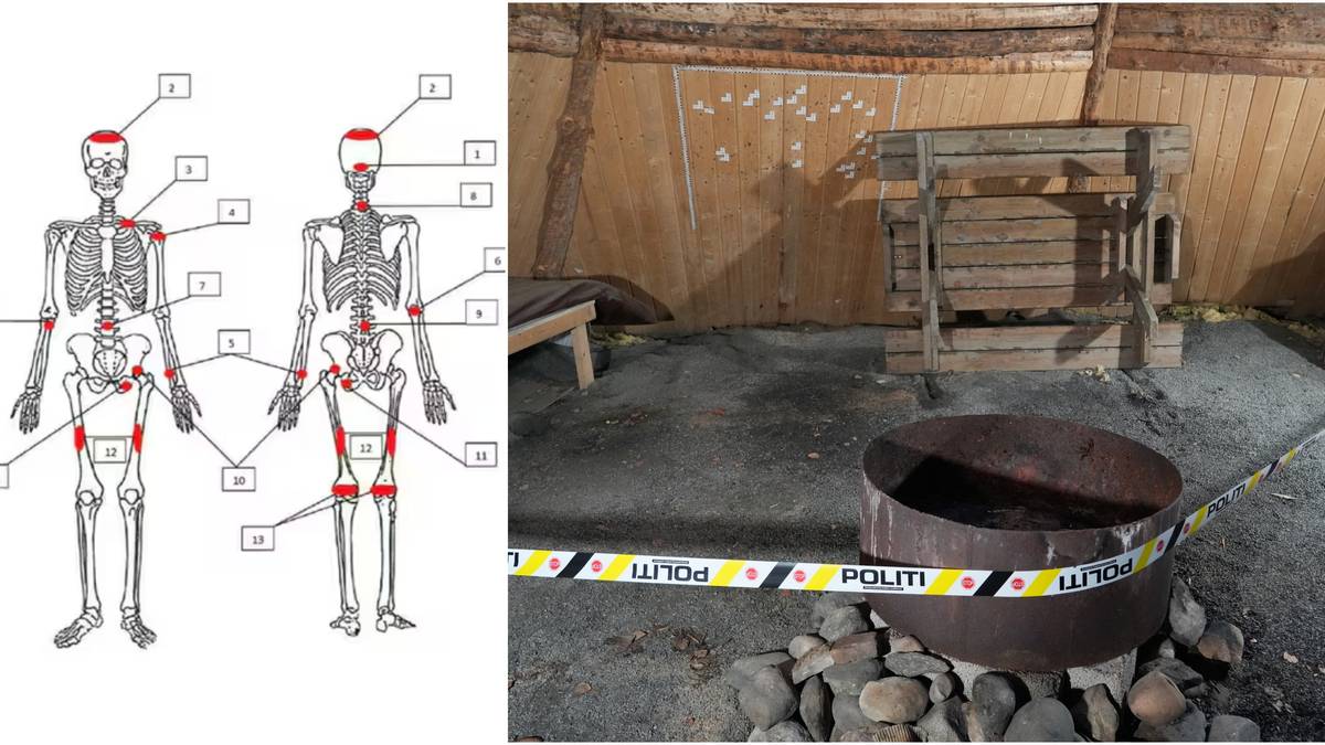 Svensk ekspert om levningene etter Løten-drapet: – Tegn på partering