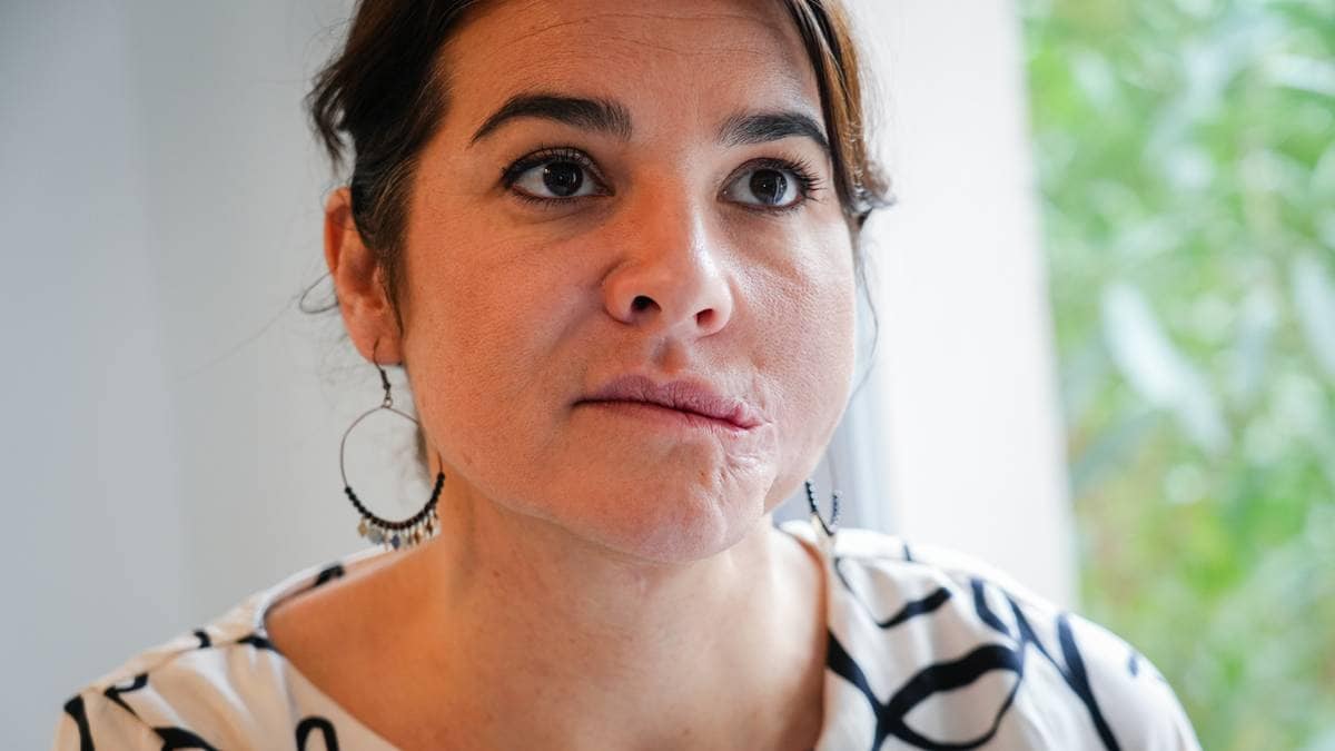 10 år etter Bataclan: Operert 56 ganger