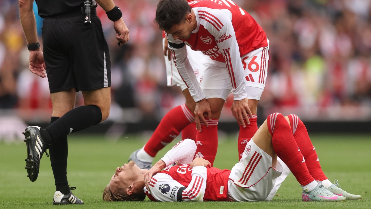 Ødegaard-bilder bekymrer ekspert: – Verste spilleren å miste
