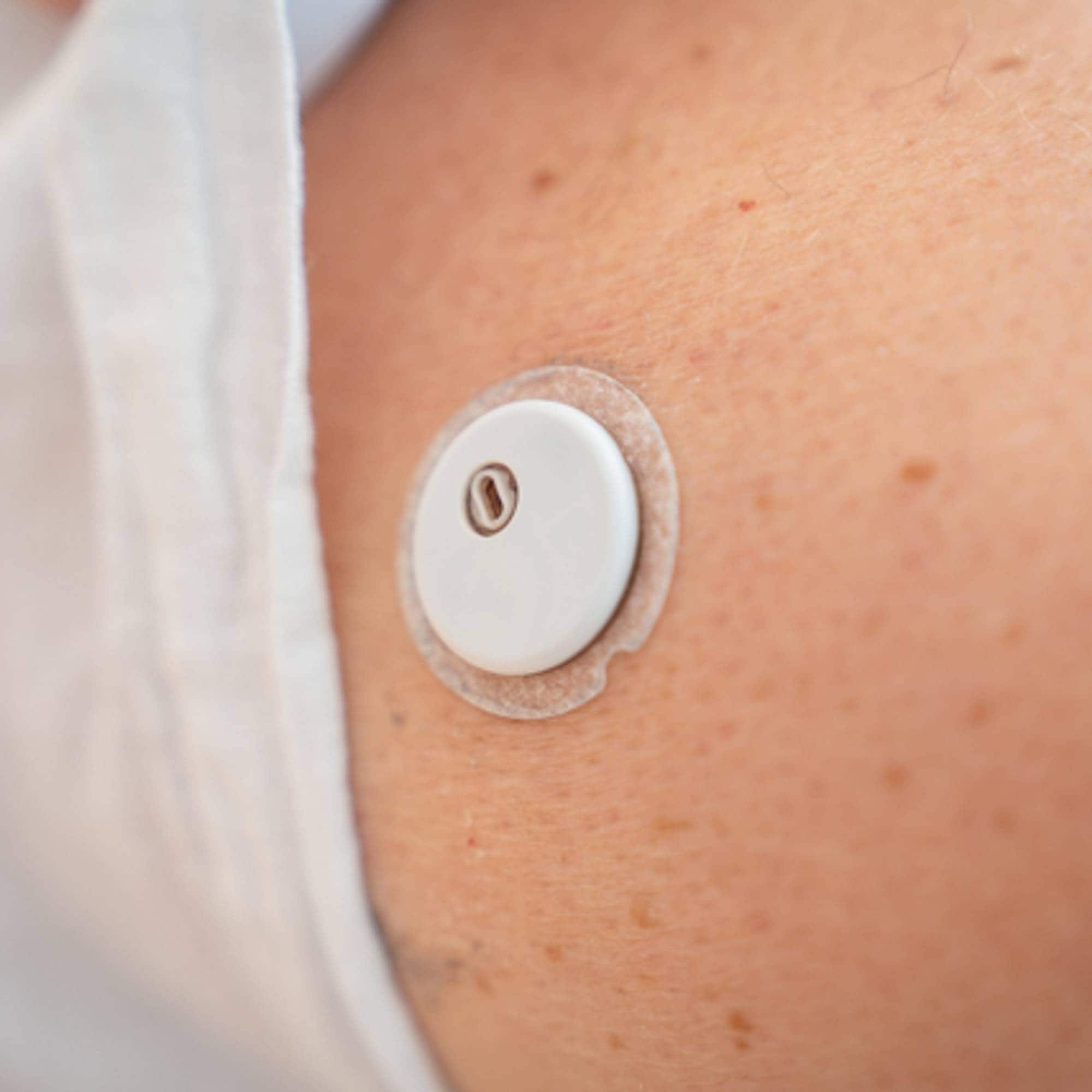Kjell Gundersen har diabetes2, og mener de med diabetes2 burde få dekket en måler slik de med diabetes1 får. Her viser han måleren han har på høyre overarm. Bildene er tatt i leiligheten hans tirsdag 11. august 2026.