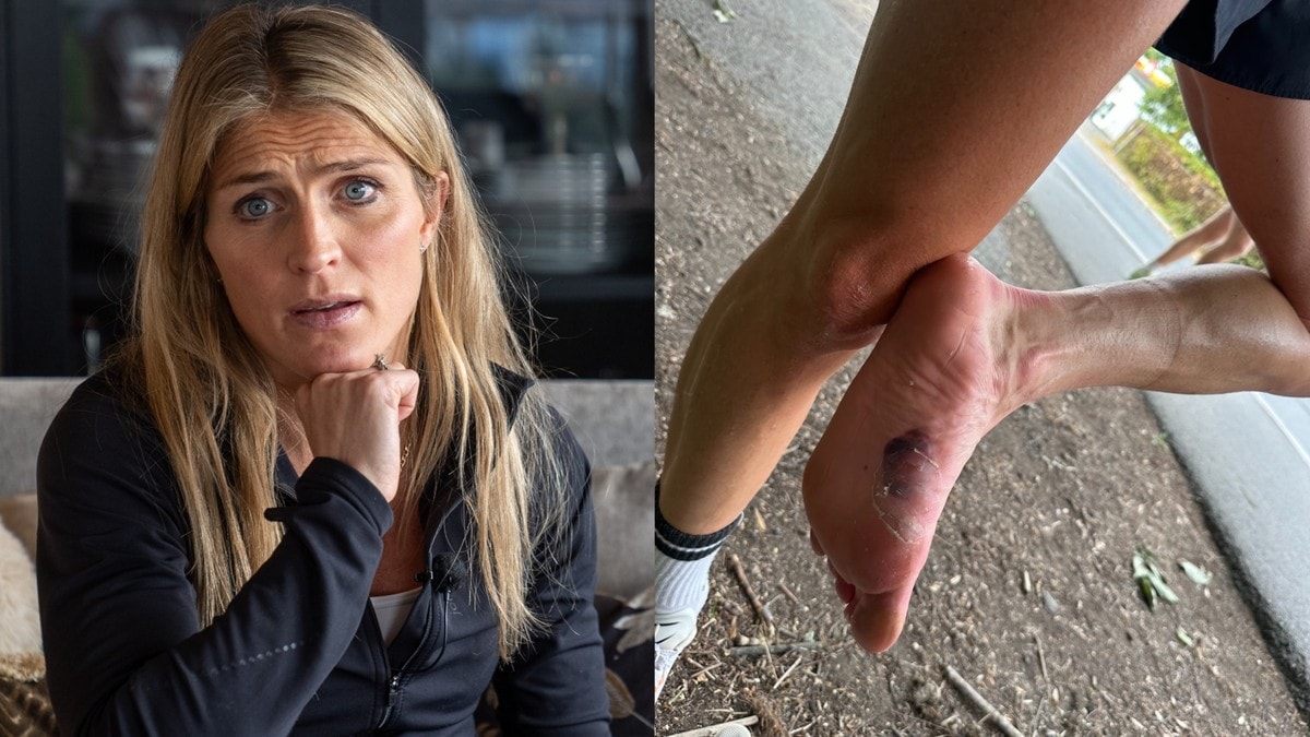 Skaden kunne stoppet Johaugs løpedrøm: – Blodet sprutet i hele sommer