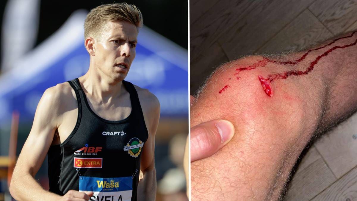 Biten av hund på løpetur – måtte trekke seg frå det store målet i haust