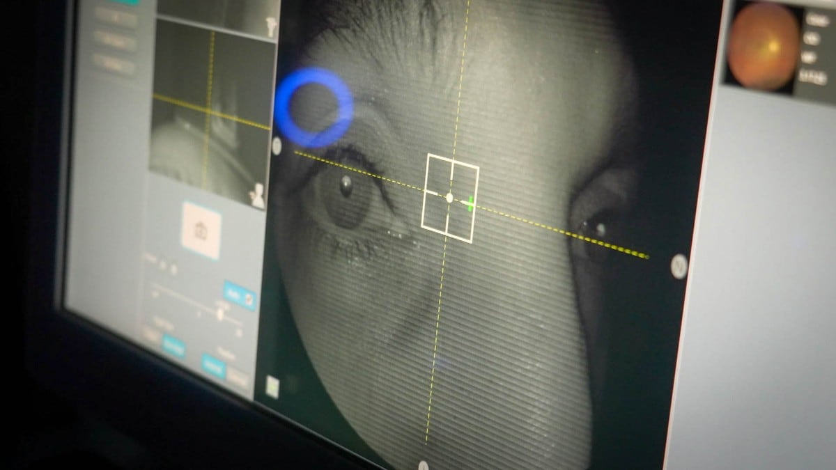 Skal bruke kunstig intelligens til å undersøke diabetespasienter
