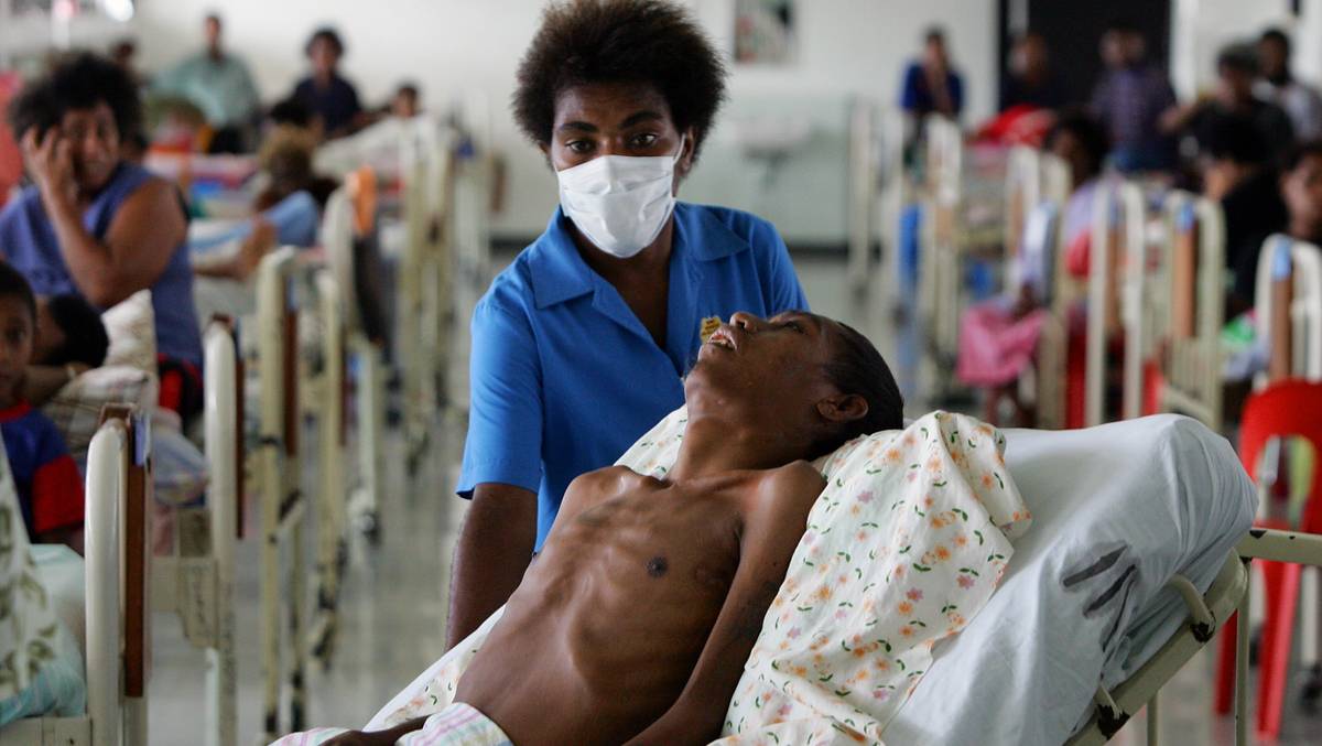 Derfor spredte hiv-viruset seg – NRK Viten – Nyheter innen vitenskap og ...