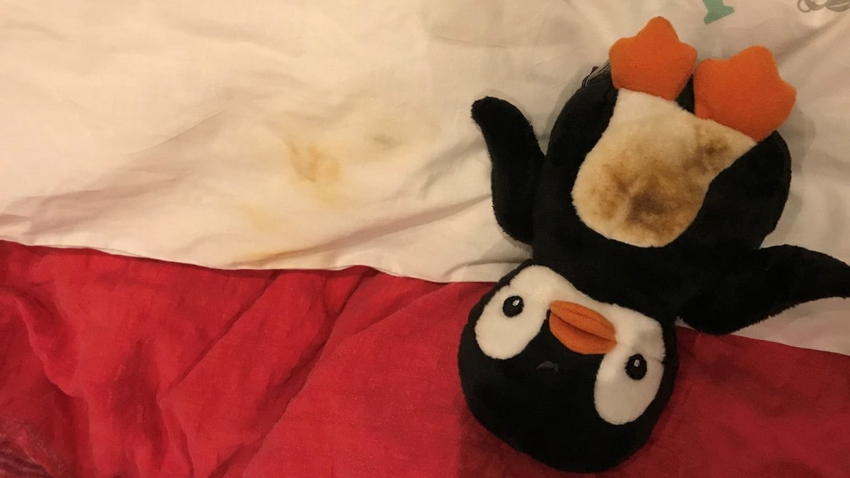 Varmebamse svidde sengetøyet i babysengen: – Det var helt jævlig