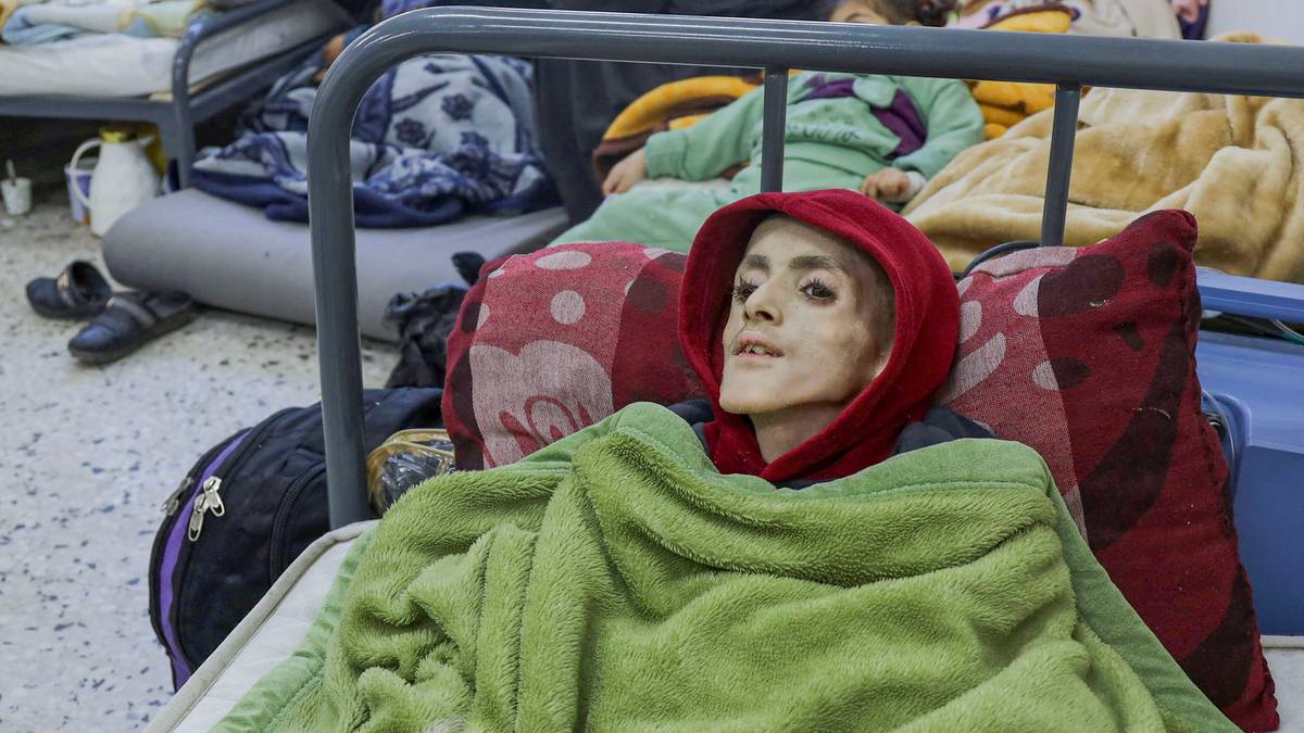 Qui giace Yazan, 12 anni, emaciato in un ospedale di Gaza – NRK Urix – Notizie e documentari esteri