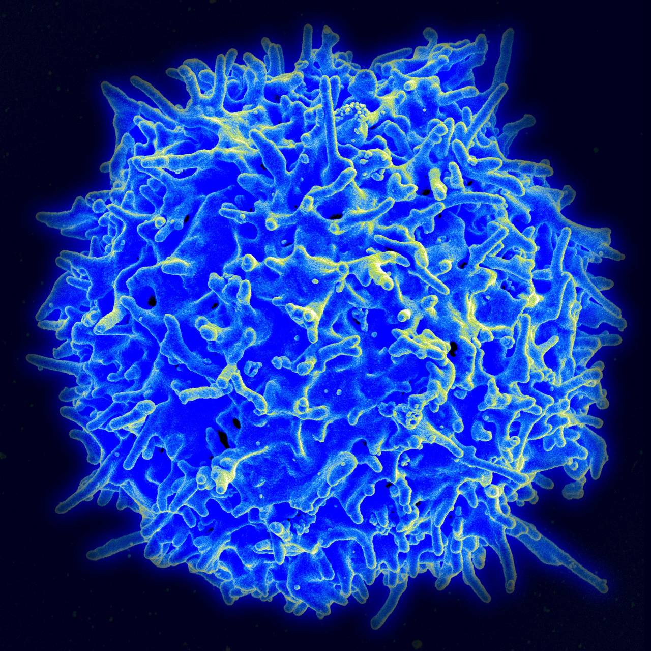 Immuncelle