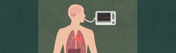 Respiratoren blåser luft i lungene. Hjertet pumper blod gjennom kroppen. Så lenge det også kommer blod til hjernen, er han i live.