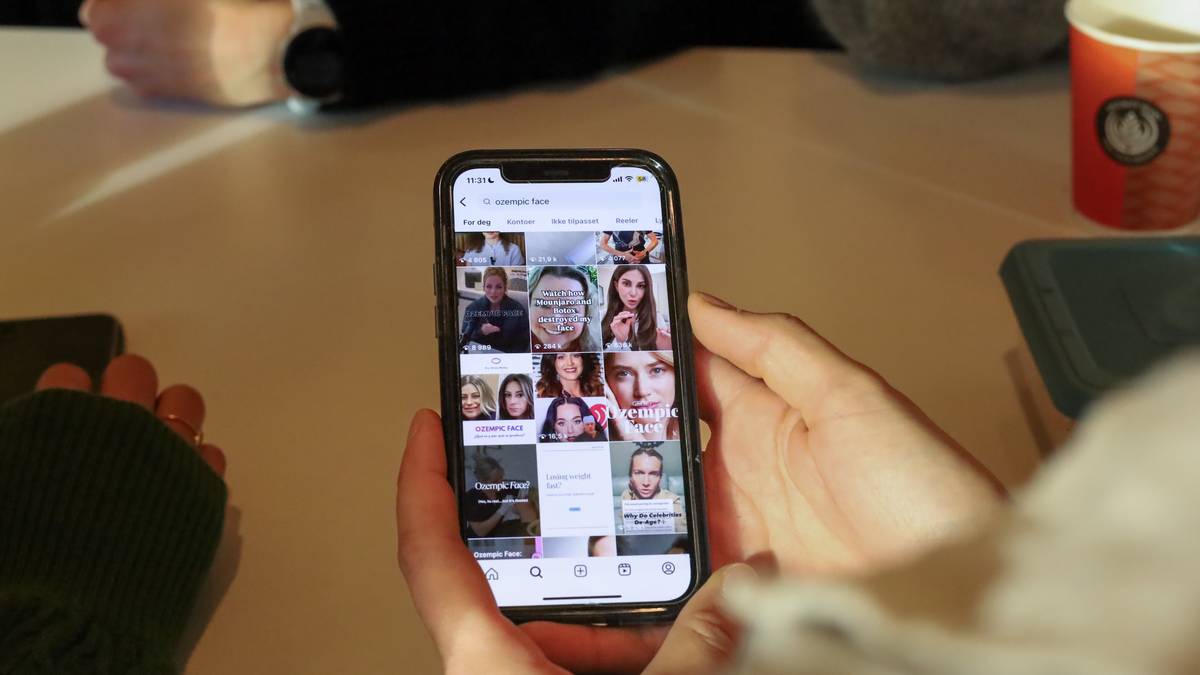 Advarer mot Tiktok-trenden #ozempicface