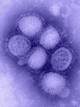 Foto: Wikimedia commons H1N1 svineinfluensa
