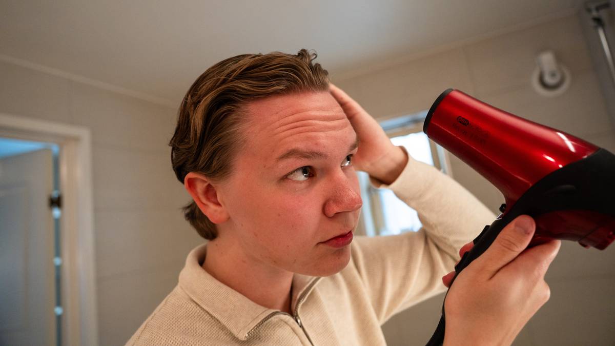 Jonathan begynte å miste håret som tenåring: – Blir litt usikker på seg sjølv