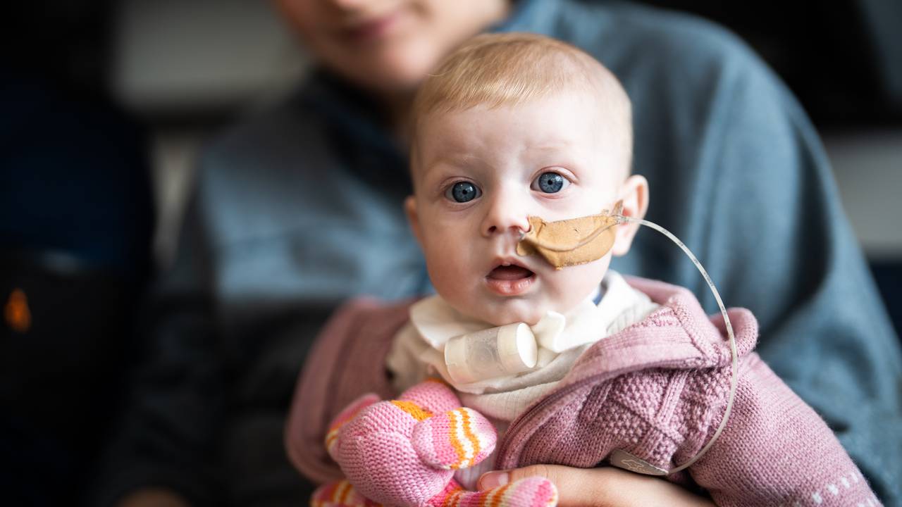 Baby Hermine Sørli Nålsund har sonde i nasen og røyr i halsen som hjelper henne med å puste.