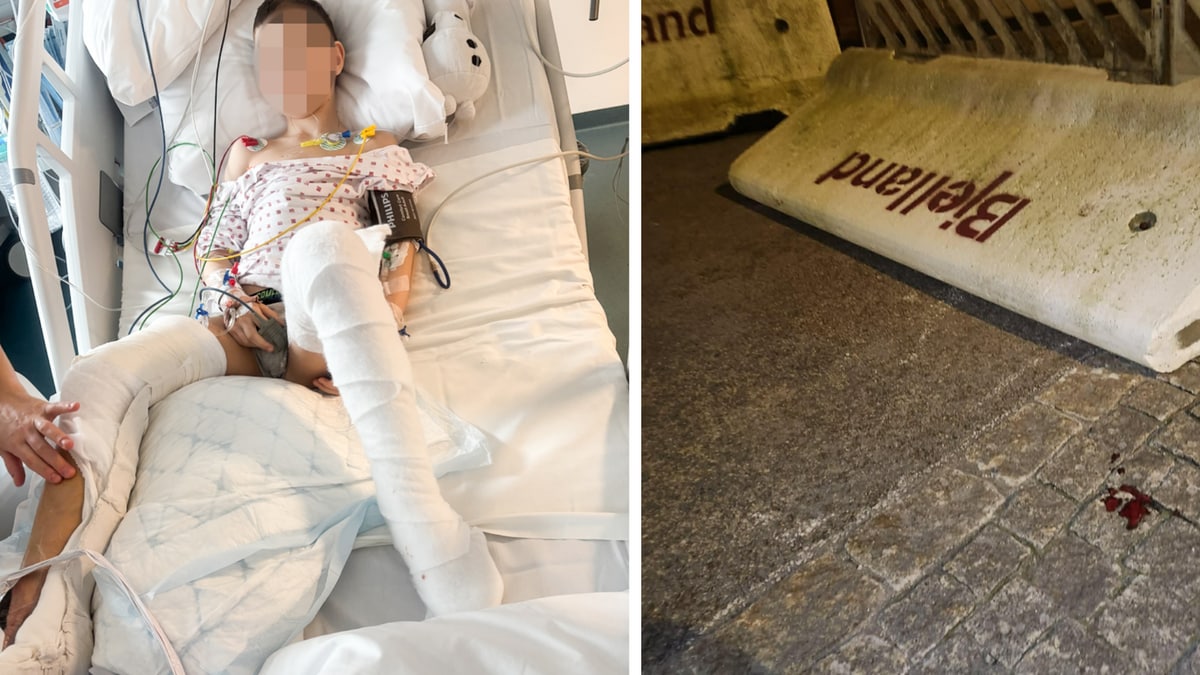 Åtte år gammel gutt fikk betongblokk over seg – i fare for å miste beinet