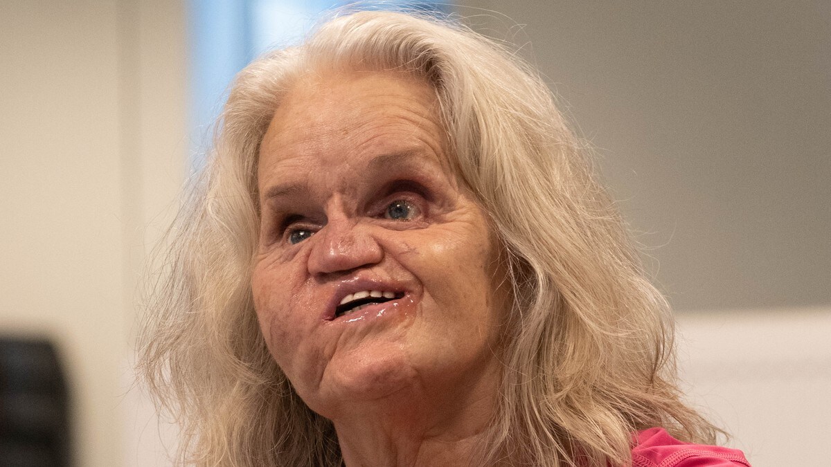 Blinde Rita Vindholmen ser klarere enn noen gang