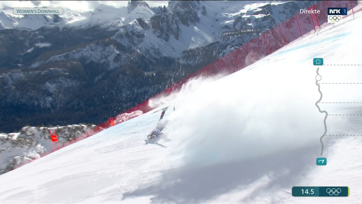 Vonns kirurger avslører: En «delikat» situasjon ble håndtert bra