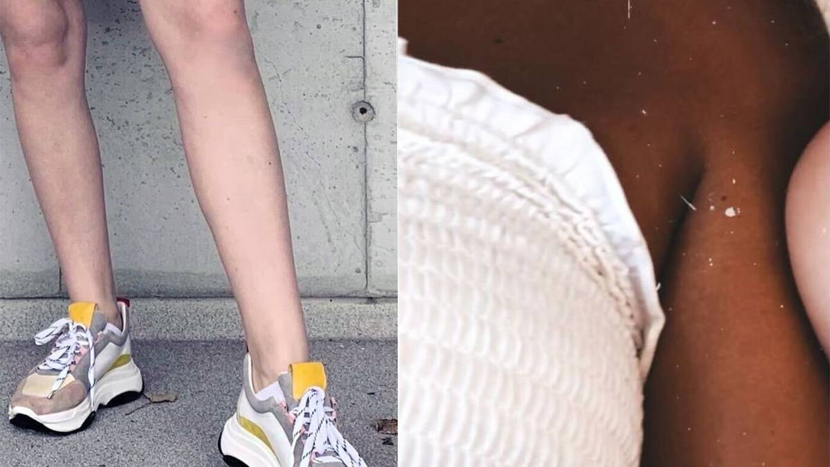 melanotan før og etter Fleire bruker melanotan på nasespray, som også blir kalla Barbie-dop – NRK  Rogaland – Lokale nyheter, TV og radio