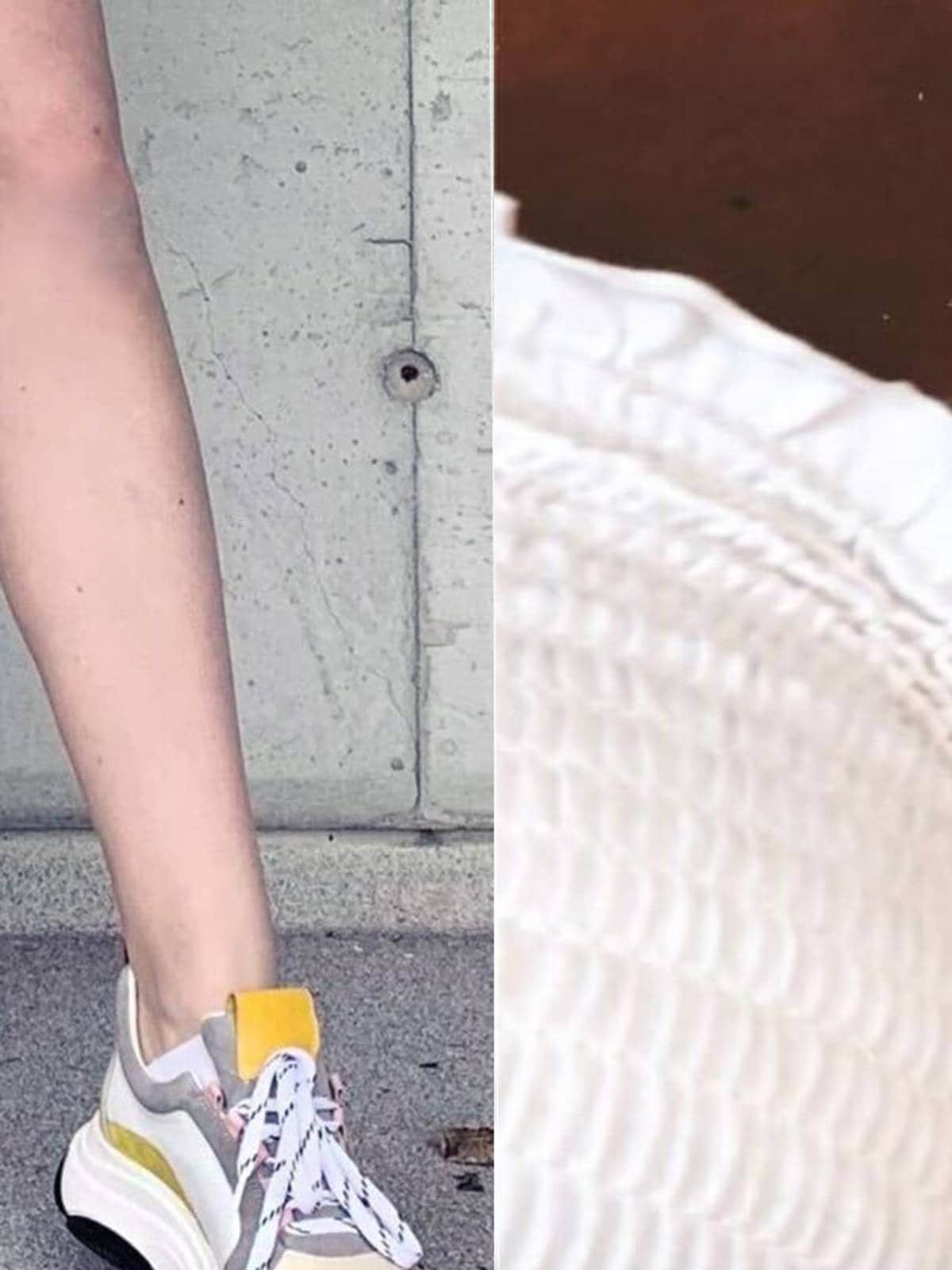 melanotan 2 10mg how much water A tan without the sun may sound tempting but it's important to understand  how these injectable tanning peptides actually work. Melanotan stimulates  melanocytes, the cells that produce melanin, leading to darker skin