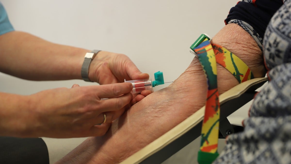 Ny blodprøve kan påvise Alzheimers sykdom tidlig