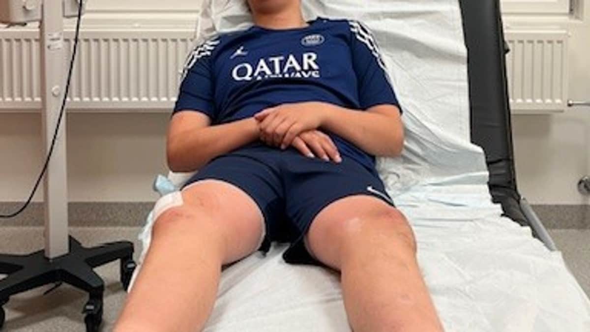 Ruter stanser elsparkesykkel-utleie etter at 12-åring ble skadet