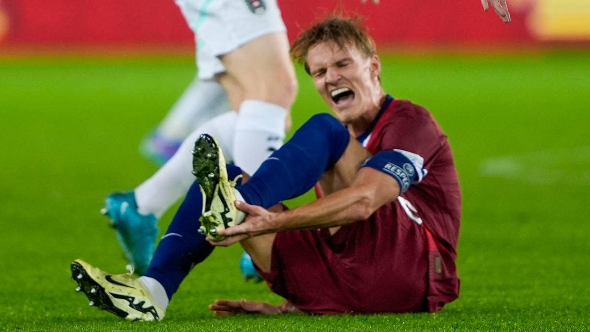 Ødegaard ikke spilleklar: – Jeg må lytte til kroppen