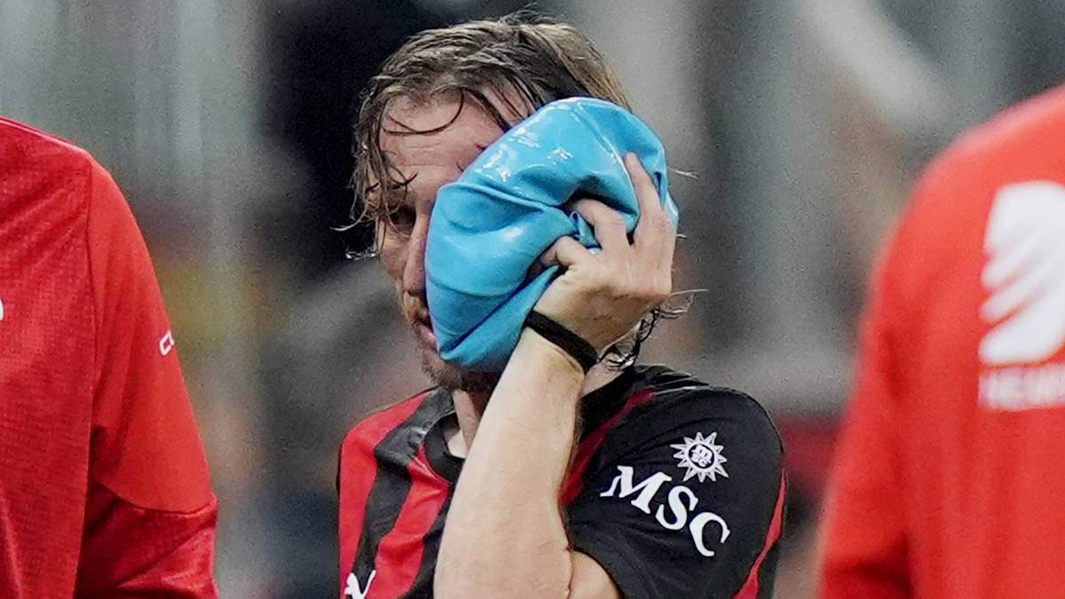 Modric-smell kort tid før VM – må opereres i ansiktet