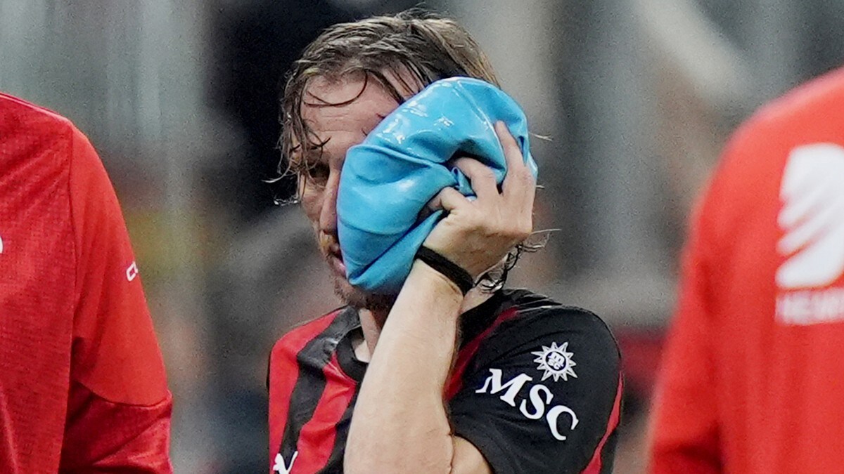 Modric-smell kort tid før VM – må opereres i ansiktet
