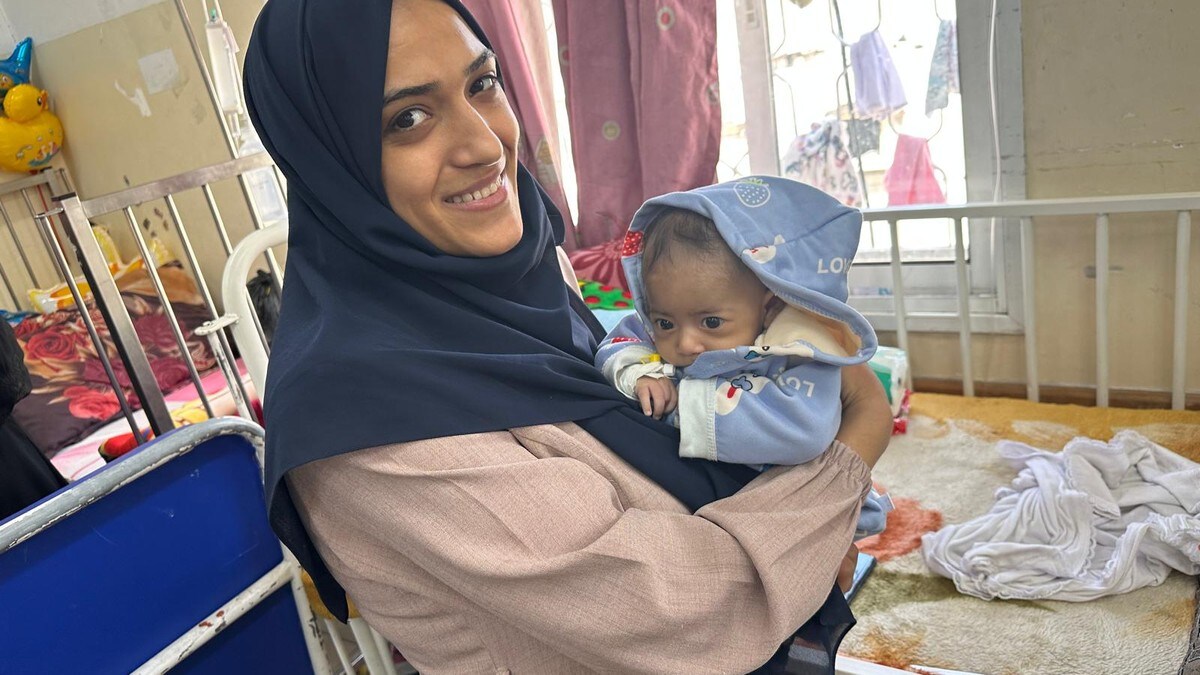 Færre underernærte barn legges inn på sykehus i Gaza