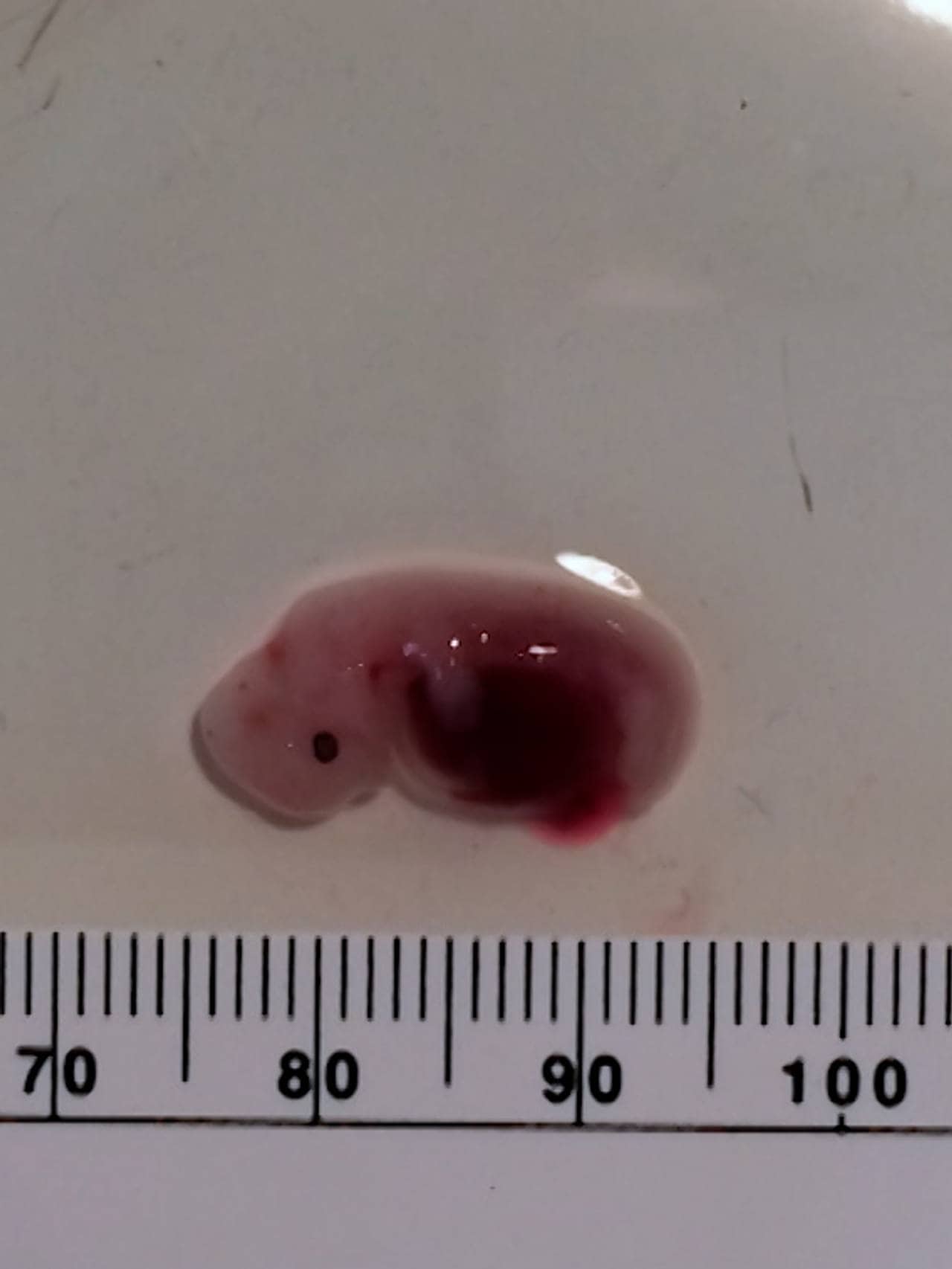 Et griseembryo med menneskeceller